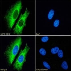 Cytokeratin 7 Rabbit anti-Human, Clone: OV-TL 12/30, Novus Biologicals:Antibodies:Primary